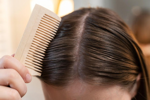 Is Oily Scalp Causing Your Hair Loss? Signs You Shouldn't Ignore (2026)